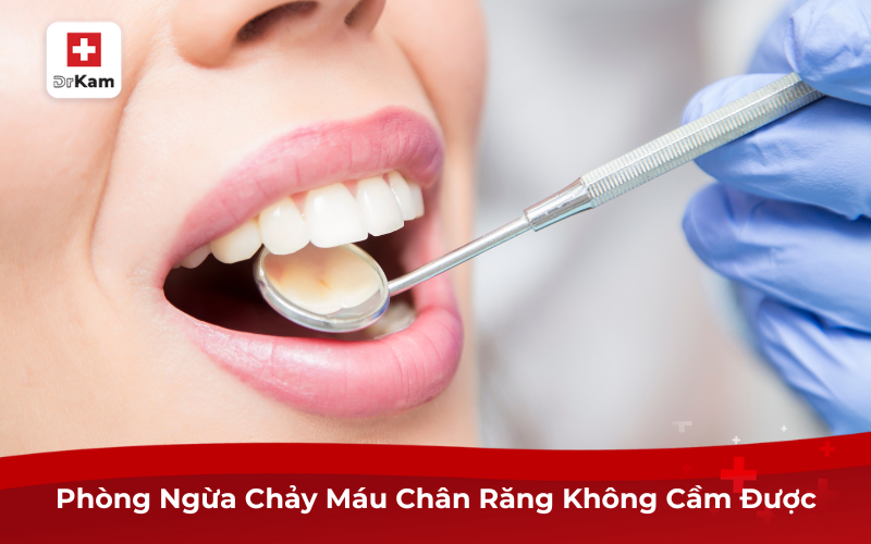 Nguyên Nhân Chảy Máu Chân Răng Không Cầm Được Và Cách Phòng Ngừa 9 Phòng ngừa chảy máu chân răng không cầm được