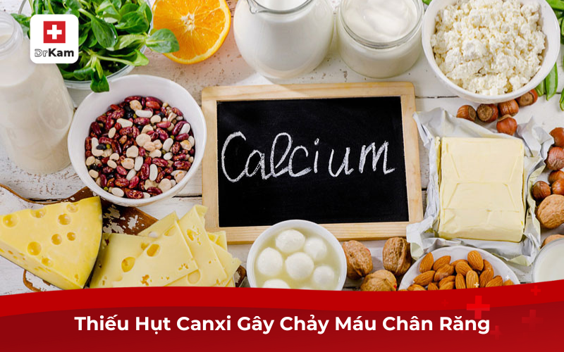 Nguyên Nhân Bầu Bị Chảy Máu Chân Răng, Cách Điều Trị Hiệu Quả 7 Bầu bị chảy máu chân răng do thiếu hụt Canxi