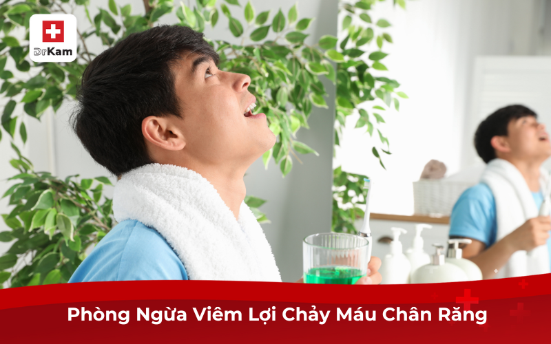 Phòng Ngừa Viêm Lợi Chảy Máu Chân Răng