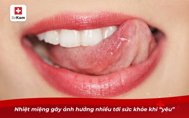 Bị nhiệt miệng quan hệ bằng miệng có sao không? 7 Nhiệt miệng gây ảnh hưởng nhiều tới sức khỏe khi “yêu”