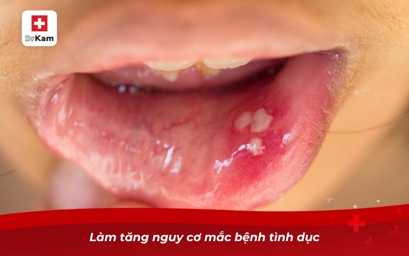 Bị nhiệt miệng quan hệ bằng miệng có sao không? 9 Làm tăng nguy cơ mắc bệnh tình dục