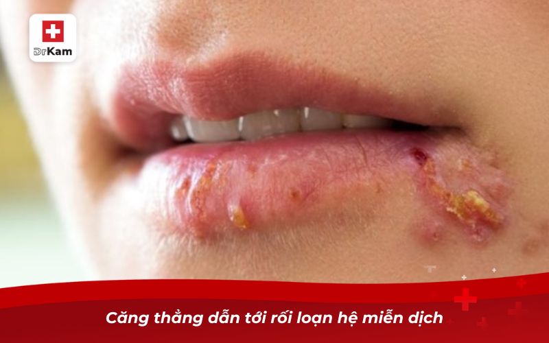 Nhiệt miệng có lây không? Sự thật ai cũng nên biết 8 Phân biệt giữa nhiệt miệng và loét miệng virus