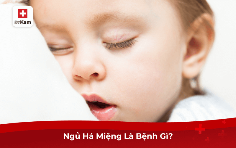Chữa Bệnh Ngủ Há Miệng Ở Trẻ Sơ Sinh Như Thế Nào? 6 Ngủ Há Miệng Là Bệnh Gì?
