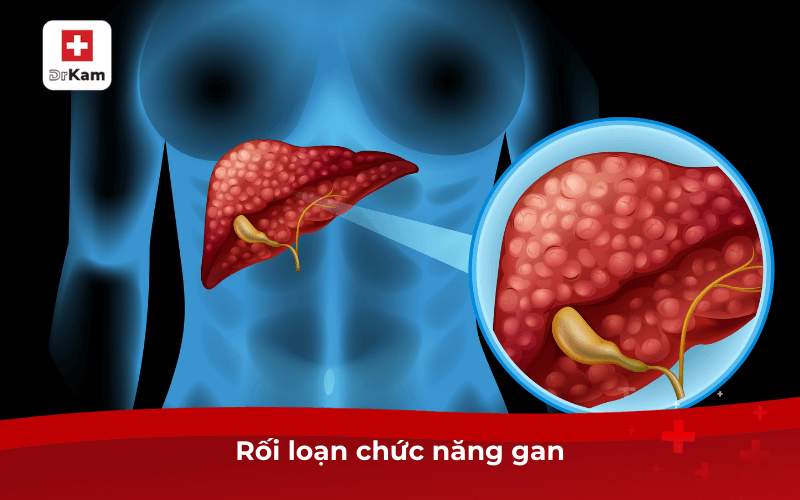 Hiện tượng sáng ngủ dậy bị đắng miệng là bệnh gì? 8 Rối loạn chức năng gan