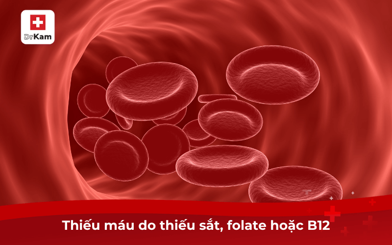 Hay bị nhiệt miệng là dấu hiệu của bệnh gì? Nguy hiểm không? 9 Thiếu máu do thiếu sắt, folate hoặc B12