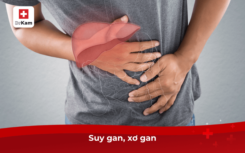 Bị hôi miệng là bệnh gì? Nguyên nhân và cách điều trị tại nhà 9 Suy gan, xơ gan