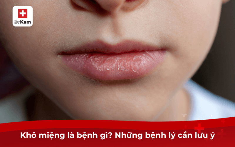 Khô miệng là bệnh gì? Cách điều trị và phòng ngừa 6 Khô miệng là bệnh gì? Những bệnh lý cần lưu ý