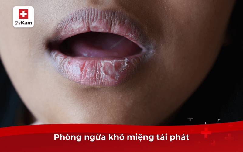 Khô miệng là bệnh gì? Cách điều trị và phòng ngừa 8 Phòng ngừa khô miệng tái phát