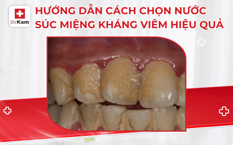 15 4 ads khang viem
