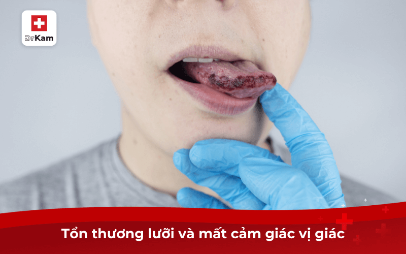 Tình trạng khô miệng rát lưỡi là bệnh gì? Nguy hiểm không? 9 Tổn thương lưỡi và mất cảm giác vị giác