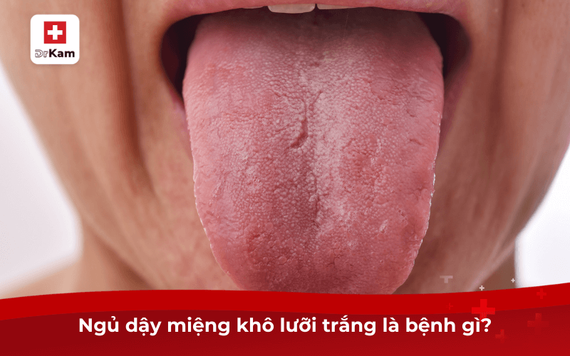 Sáng ngủ dậy miệng khô lưỡi trắng là bệnh gì? 6 Ngủ dậy miệng khô lưỡi trắng là bệnh gì?