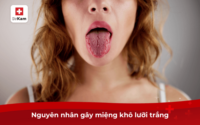 Sáng ngủ dậy miệng khô lưỡi trắng là bệnh gì? 7 Nguyên nhân gây miệng khô lưỡi trắng