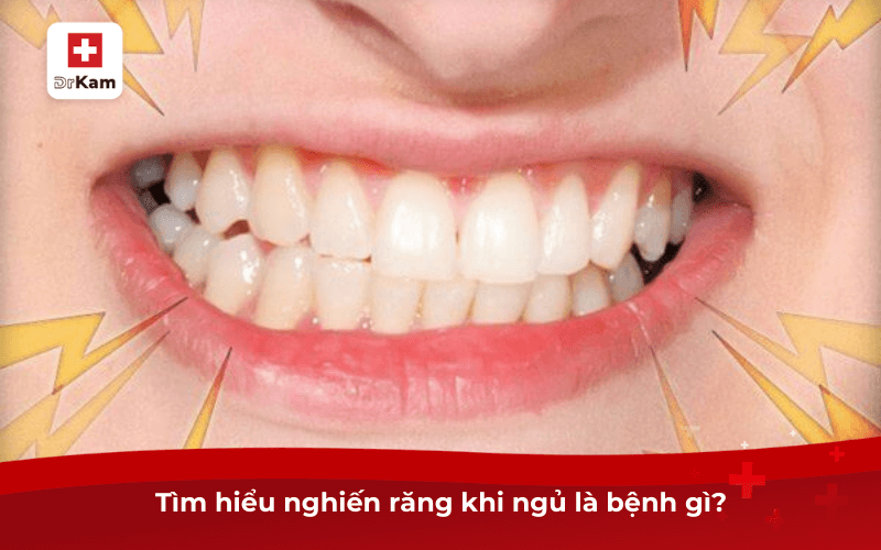 Nghiến răng khi ngủ là bệnh gì? Có tác hại thế nào? 6 Tìm hiểu nghiến răng khi ngủ là bệnh gì?