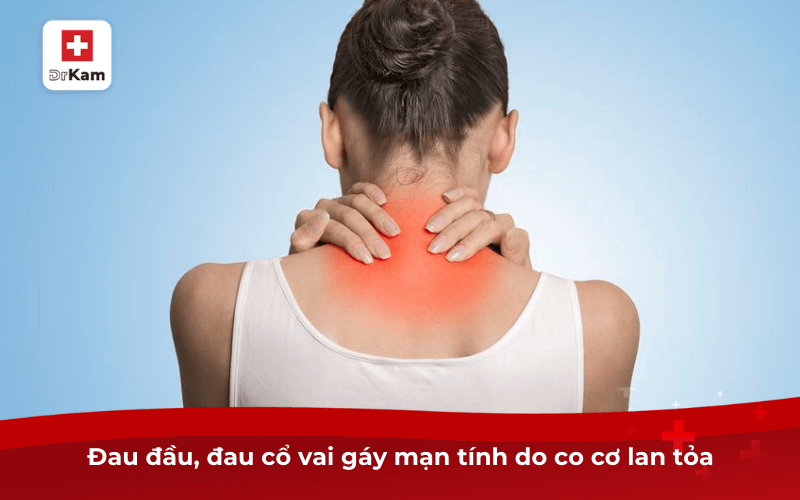 Nghiến răng khi ngủ là bệnh gì? Có tác hại thế nào? 9 Đau đầu, đau cổ vai gáy mạn tính do co cơ lan tỏa