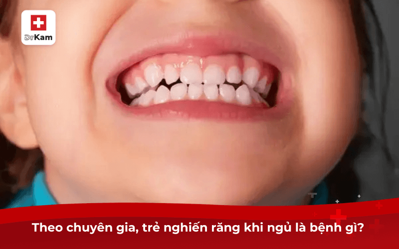 Theo chuyên gia, trẻ nghiến răng khi ngủ là bệnh gì? 