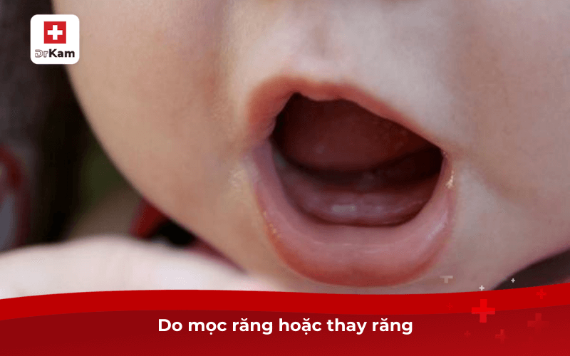 Do mọc răng hoặc thay răng
