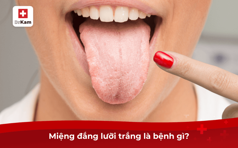 Thường xuyên miệng đắng lưỡi trắng là bệnh gì? 6 Miệng đắng lưỡi trắng là bệnh gì?