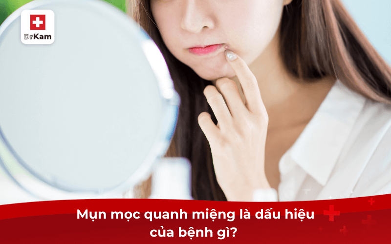 Tự nhiên mụn mọc quanh miệng là dấu hiệu của bệnh gì 6 Mụn mọc quanh miệng là dấu hiệu của bệnh gì?