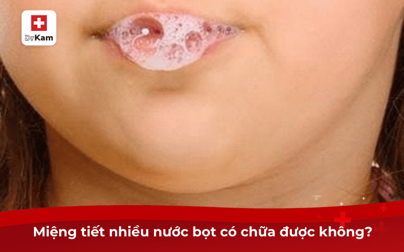 Miệng tiết nhiều nước bọt là bệnh gì? Các điều trị 7 Miệng tiết nhiều nước bọt có chữa được không?