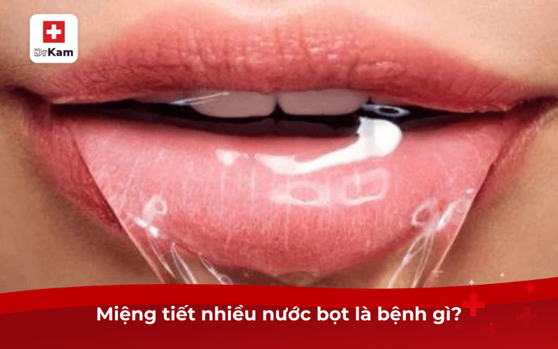 Miệng tiết nhiều nước bọt là bệnh gì? Các điều trị 6 Miệng tiết nhiều nước bọt là bệnh gì?