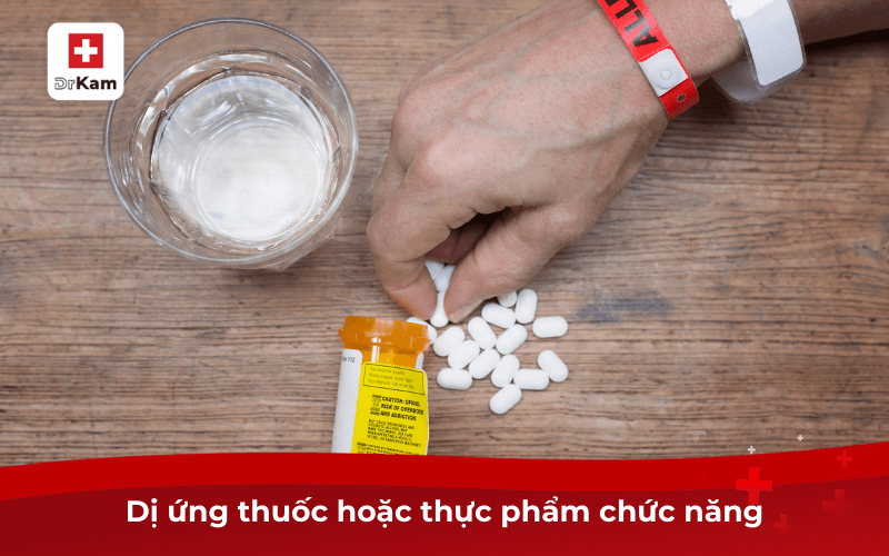 Thường xuyên ngứa trong miệng là bệnh gì? Chữa thế nào? 8 Dị ứng thuốc hoặc thực phẩm chức năng