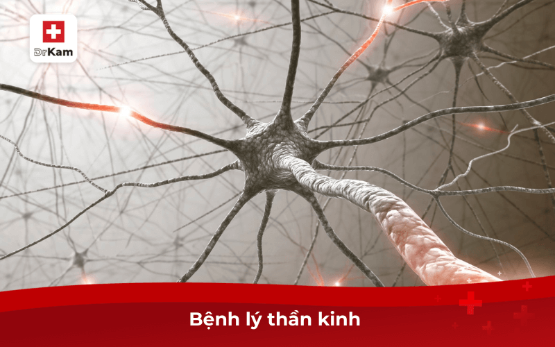 Ăn uống bị nhạt miệng là bệnh gì? Nguyên nhân do đâu 8 Bệnh lý thần kinh