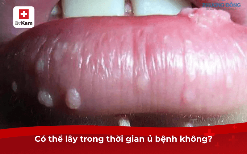 Có thể lây trong thời gian ủ bệnh không?