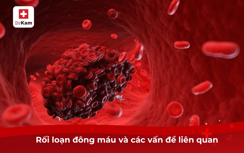 Tình Trạng Chảy Máu Trong Miệng Là Bệnh Gì? Nguyên Nhân 7 Rối loạn đông máu và các vấn đề liên quan