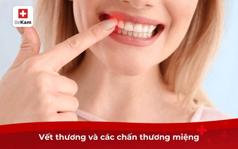 Tình Trạng Chảy Máu Trong Miệng Là Bệnh Gì? Nguyên Nhân 9 Vết thương và các chấn thương miệng