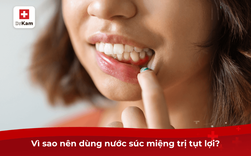Top 5 loại nước súc miệng trị tụt lợi giá tốt hiệu quả 6 Vì sao nên dùng nước súc miệng trị tụt lợi?
