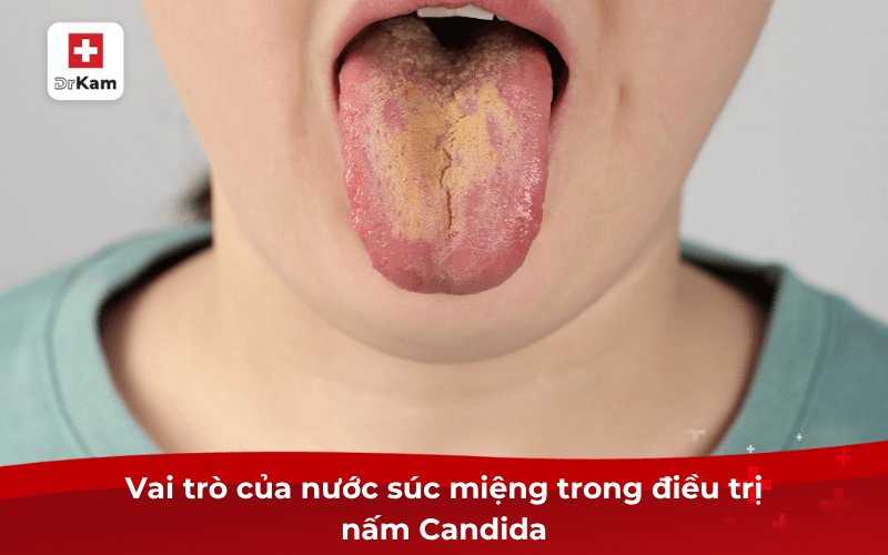 Nước súc miệng trị nấm candida có thật sự hiệu quả? 6 Vai trò của nước súc miệng trong điều trị nấm Candida
