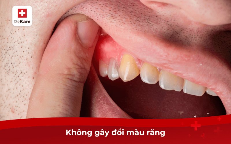 Top 7 nước súc miệng trị viêm nướu hiệu quả nhất hiện nay 7 Không gây đổi màu răng