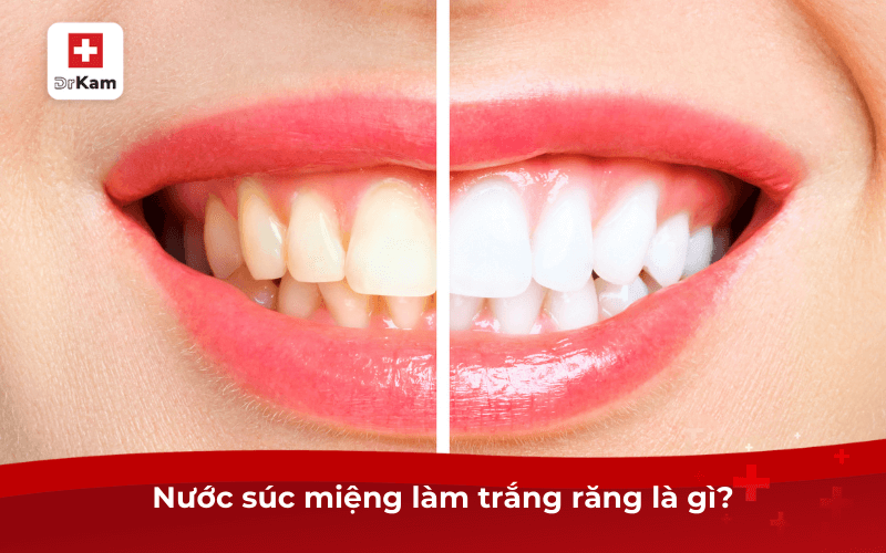 Nước súc miệng làm trắng răng có thật sự hiệu quả không? 6 Nước súc miệng làm trắng răng là gì?