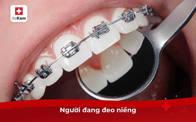 Nước súc miệng loại bỏ cao răng có thật sự hiệu quả? 8 Người đang đeo niềng