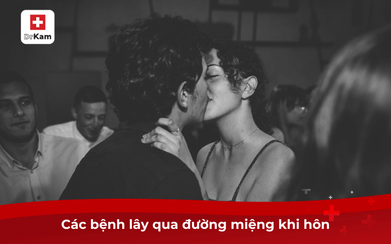 Các bệnh lây qua đường miệng khi hôn