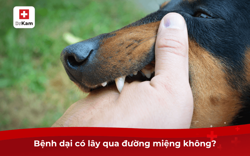 Bệnh dại có lây qua đường miệng không? Biện pháp điều trị 7 Bệnh dại có lây qua đường miệng không?