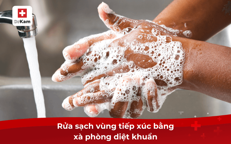 Bệnh dại có lây qua đường miệng không? Biện pháp điều trị 8 Rửa sạch vùng tiếp xúc bằng xà phòng diệt khuẩn