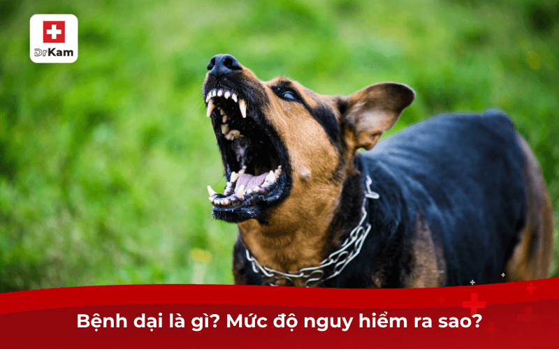 Bệnh dại có lây qua đường miệng không? Biện pháp điều trị 6 Bệnh dại là gì? Mức độ nguy hiểm ra sao?