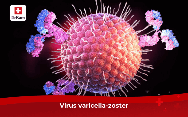 Virus varicella-zoster