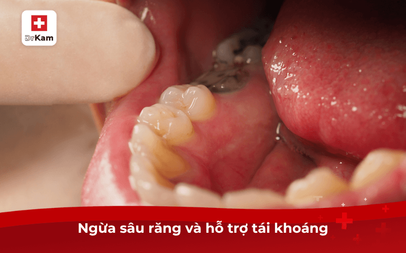 Ngừa sâu răng và hỗ trợ tái khoáng