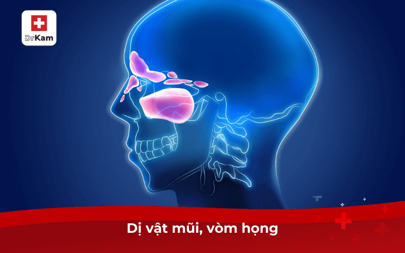 Trẻ em bị hôi miệng là bệnh gì? Điều trị và phòng ngừa 8 Dị vật mũi, vòm họng
