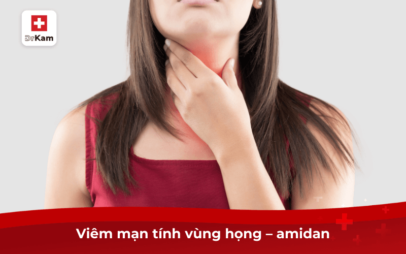 Triệu chứng vùng miệng dấu hiệu bệnh lậu ở nữ là gì? 9 Viêm mạn tính vùng họng – amidan