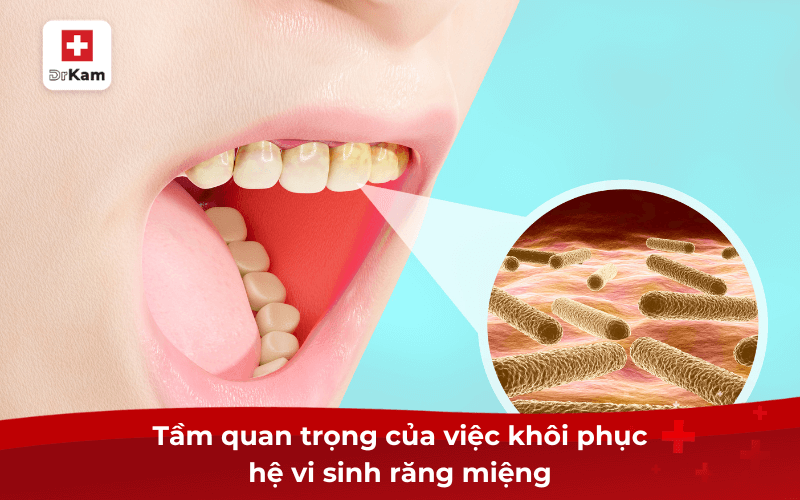 Tầm quan trọng của việc khôi phục hệ vi sinh răng miệng