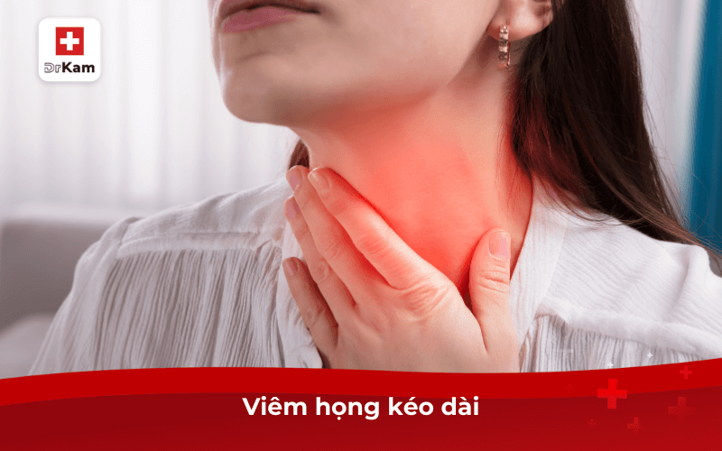 Dấu hiệu bệnh xã hội ở miệng và cách điều trị hiệu quả 8 Viêm họng kéo dài