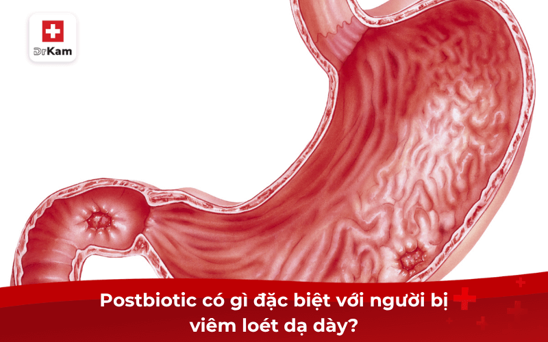Nên sử dụng postbiotic cho người bị viêm loét dạ dày không? 7 Postbiotic có gì đặc biệt với người bị viêm loét dạ dày?