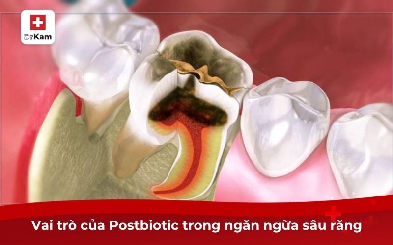 Postbiotic Ngừa Sâu Răng – Giải Pháp Lợi Khuẩn Răng Miệng 8 Vai trò của Postbiotic trong ngăn ngừa sâu răng
