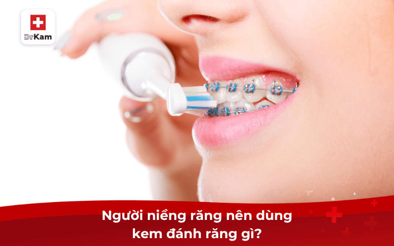 Tìm hiểu kem đánh răng vi sinh cho người niềng răng 9 Người niềng răng nên dùng kem đánh răng gì?