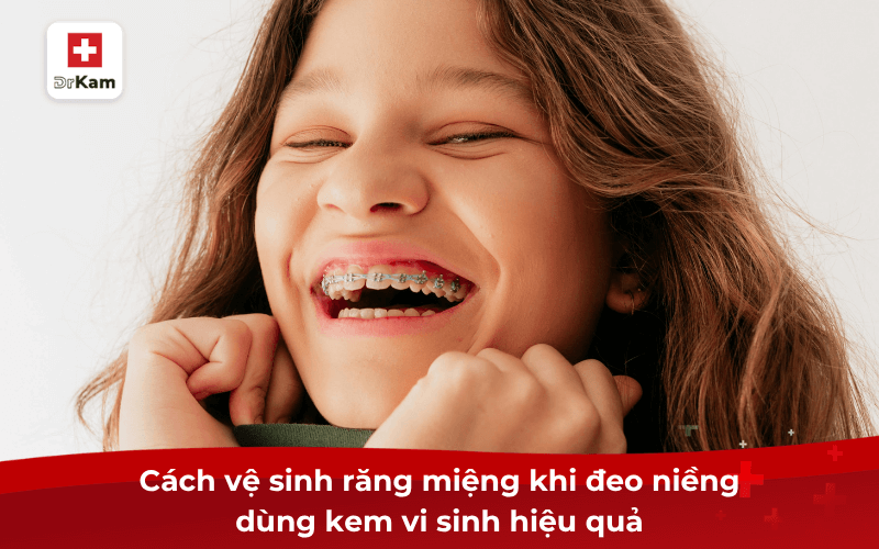 Tìm hiểu kem đánh răng vi sinh cho người niềng răng 10 Cách vệ sinh răng miệng khi đeo niềng dùng kem vi sinh hiệu quả
