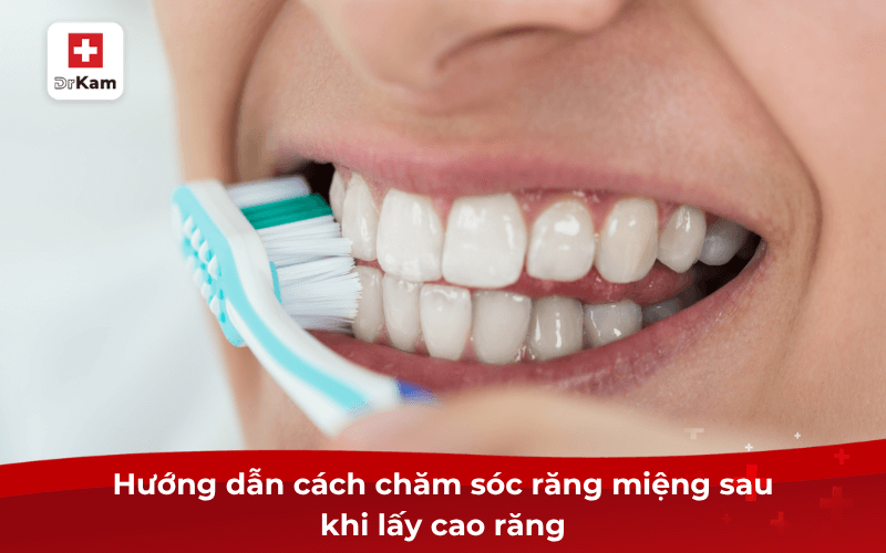Vì sao nên chăm sóc răng miệng sau khi lấy cao răng? 8 Hướng dẫn cách chăm sóc răng miệng sau khi lấy cao răng