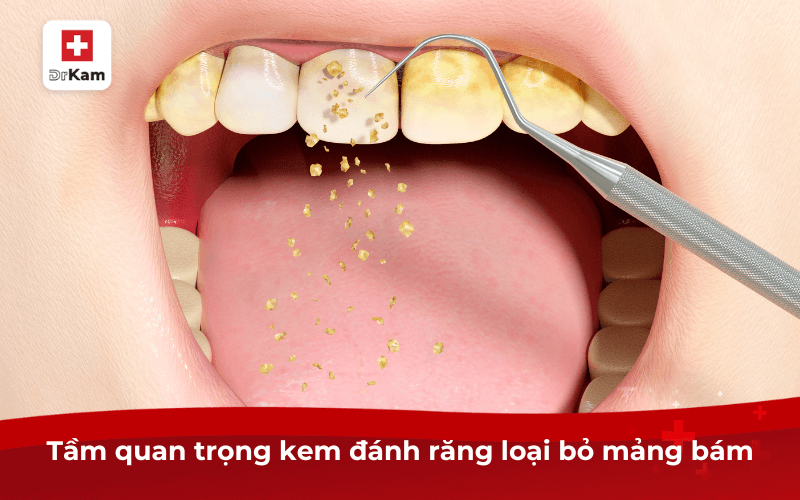 Top 3 kem đánh răng sạch mảng bám hiệu quả và 5 lưu ý 7 Tầm quan trọng kem đánh răng loại bỏ mảng bám